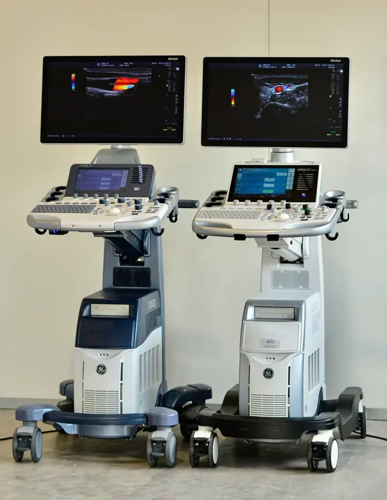 GE Logiq Ultrasound Scanners