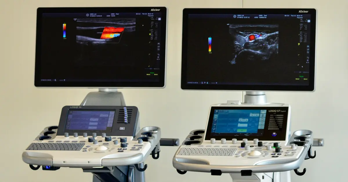 GE Logiq Ultrasound Scanners