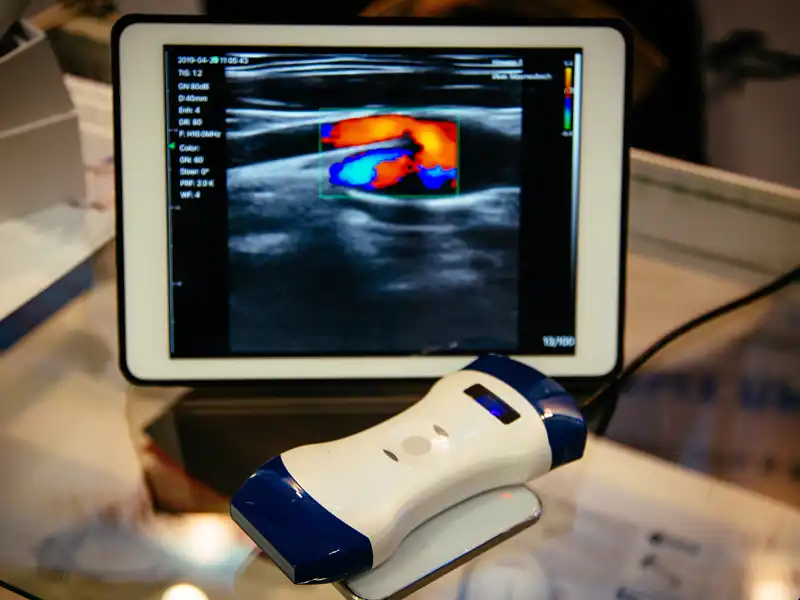 Handheld ultrasound scanner